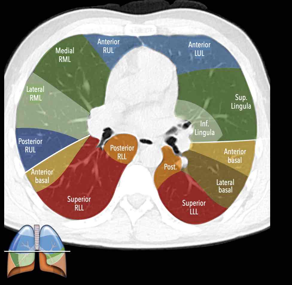 Lung Lobes Anterior Chest Lung Segments Anatomy